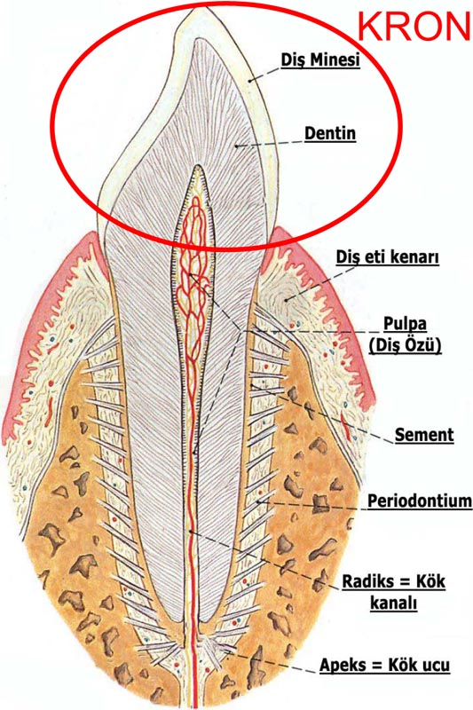 Kron Nedir? Diş Kronu = Diş Minesi + Dentin Kron Nedir? Diş Kronu = Diş Minesi + Dentin